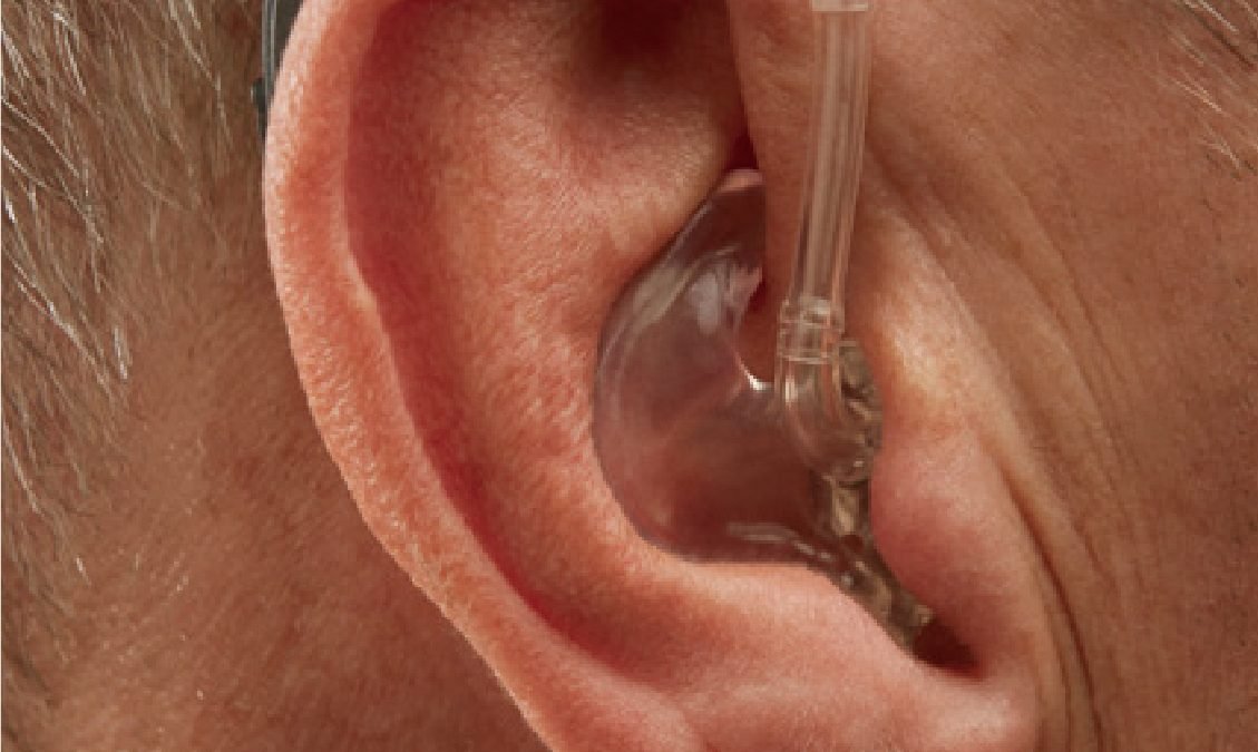 耳膜 助聽器 頌恩 送恩助聽器