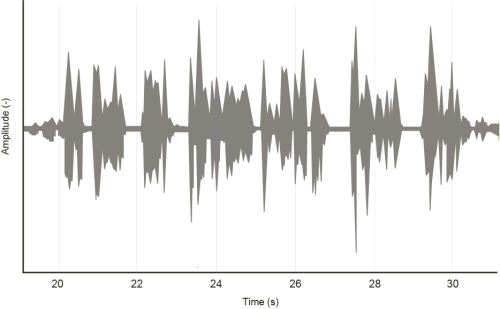 Phonak Infinio autosense OS 6.0 運作原理