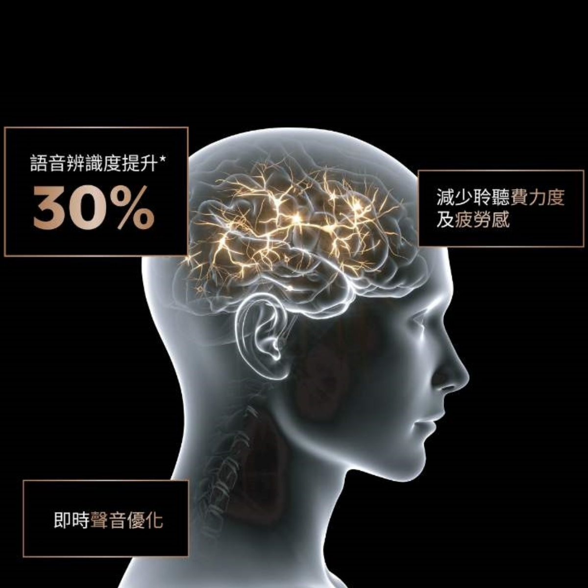 starkey edge Ai 優勢 助聽器特點 AI助聽器 美國助聽器 斯達克助聽器 Starkey助聽器